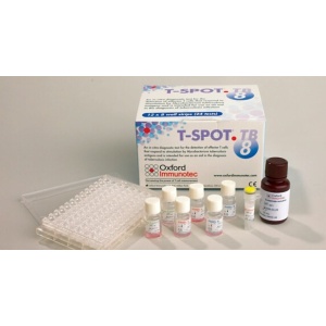 Teste pentru depistarea infectiilor latente TBC